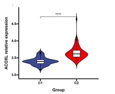 Open access visualization of Violin Plot, Box Plot, ACOXL, Expression Distribution, C2 Cluster