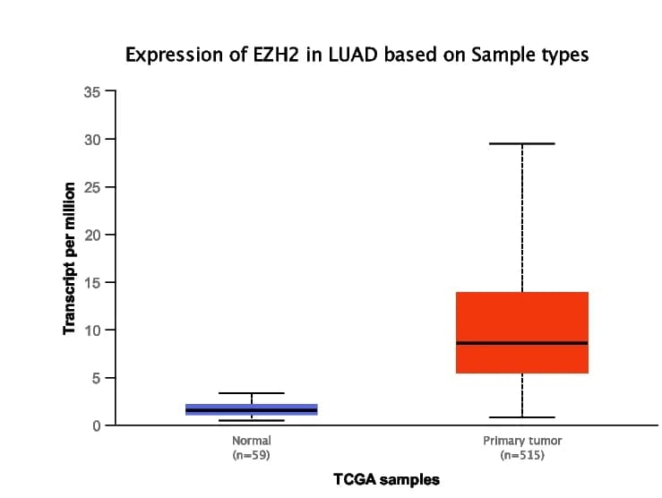 Open access visualization of Box Plot, EZH2 mRNA, Tumor Specimens, Healthy Specimens, UALCAN Database