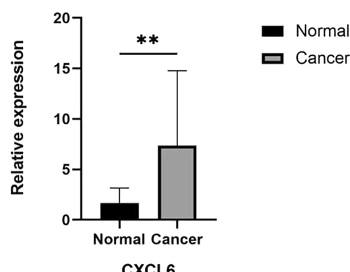 Open access visualization of Bar Plot, Error Bars, CXCL6, mRNA levels, GC tissues