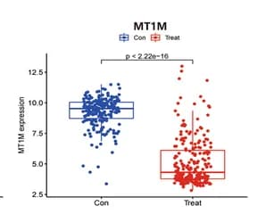 Open access visualization of Box Plot, Raincloud Plot, MT1M, Gene Expression, HCC