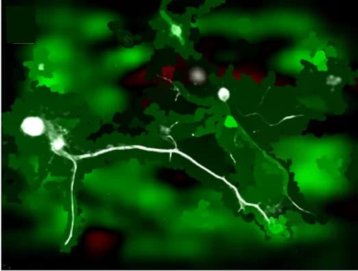 Open access visualization of Microscopy, rDRGNs, Saliency Map