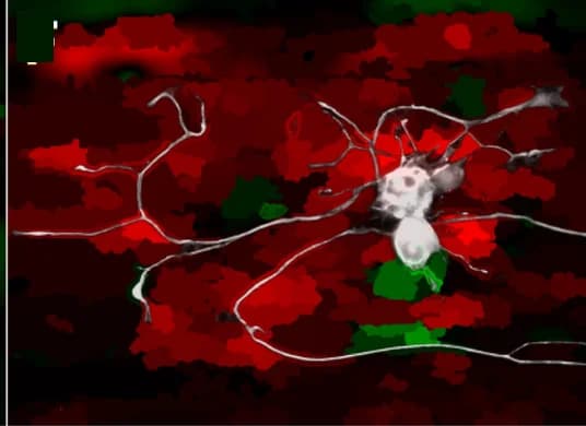 Open access visualization of Microscopy, rDRGNs, Saliency Map