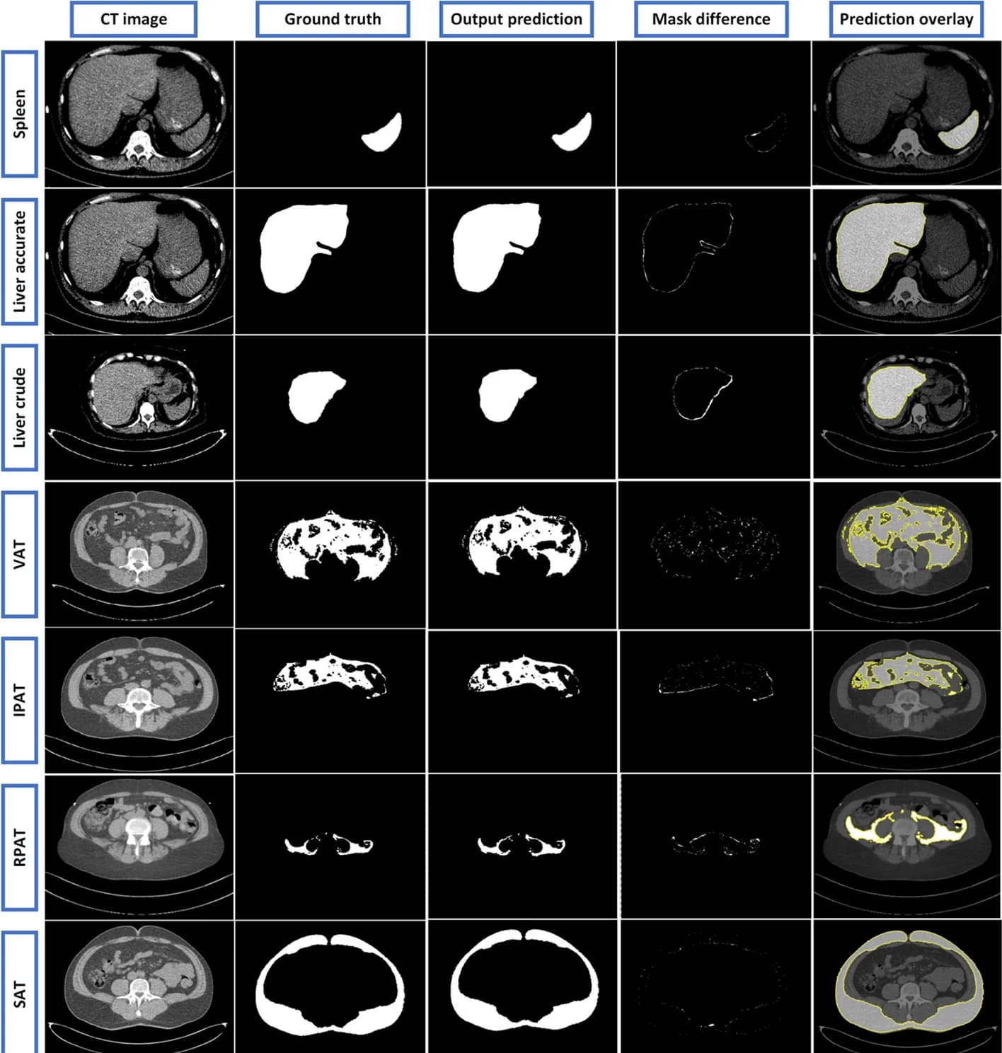 Open access visualization of Microscopy, UNET++ Model, CT Image, Image Segmentation, Spleen