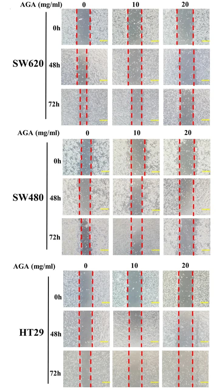 Open access visualization of Microscopy, Cell Motility, Wound-Healing Assay, Colon Cancer Cells, Photomicrographs