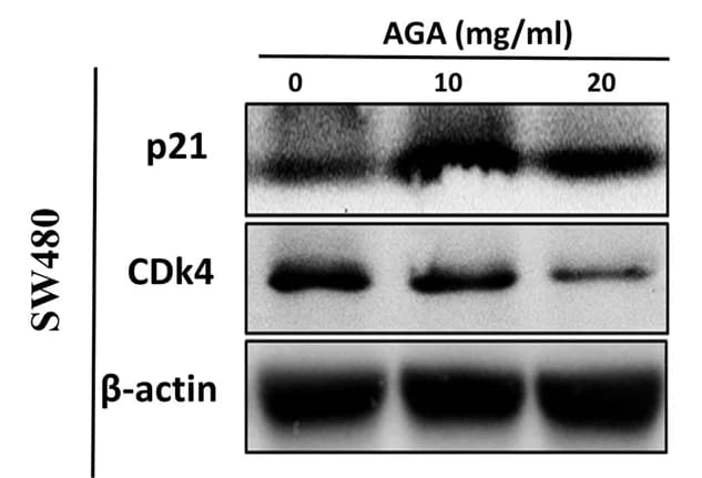 Open access visualization of Gel, Immunoblot Analysis, Cell Cycle Regulators, AGA Extract, Colon Cancer Cells