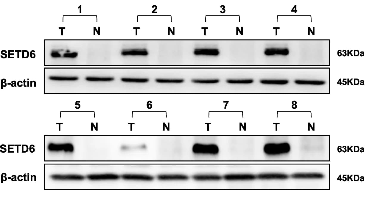 Open access visualization of Gel, Western Blot, SETD6, LUAD, Tumor Tissues
