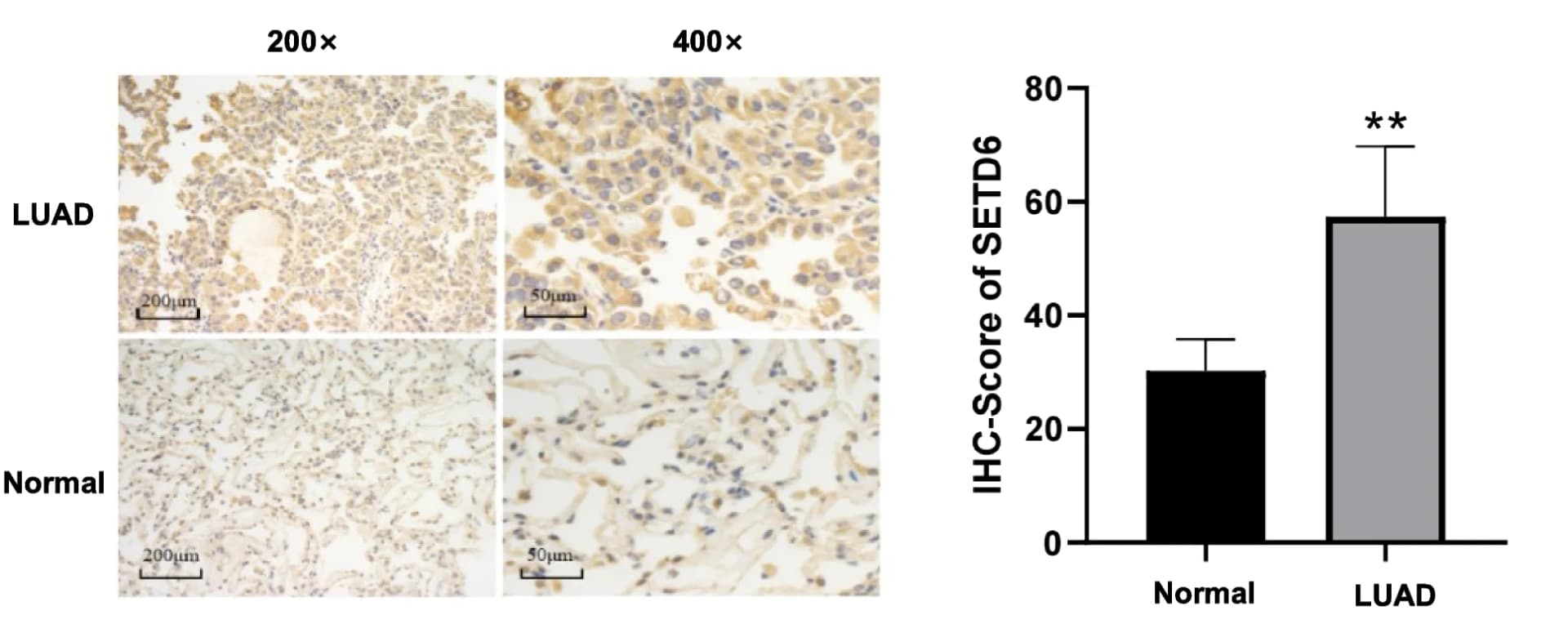 Open access visualization of Bar Plot, Error Bars, Microscopy, IHC Staining, SETD6