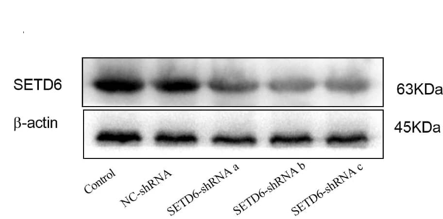 Open access visualization of Gel, Western Blot, SETD6, A549 Cells, NC-shRNA