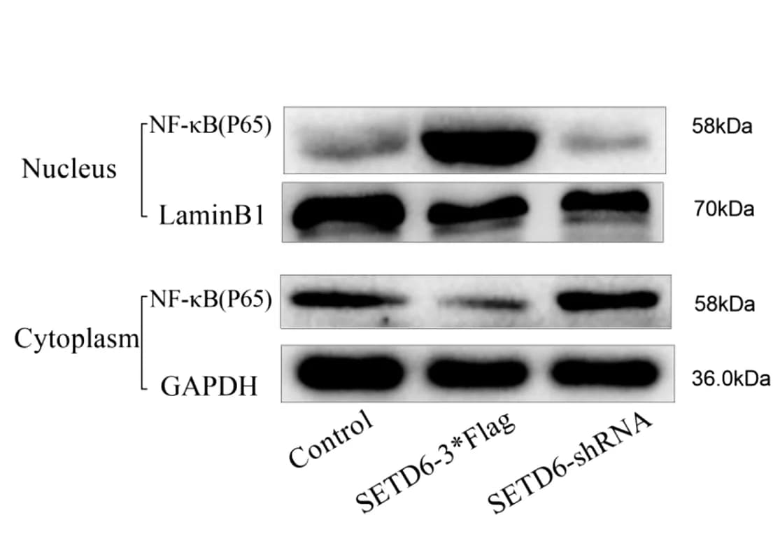 Open access visualization of Gel, Western Blot, P65, A549 Cells, LaminB1
