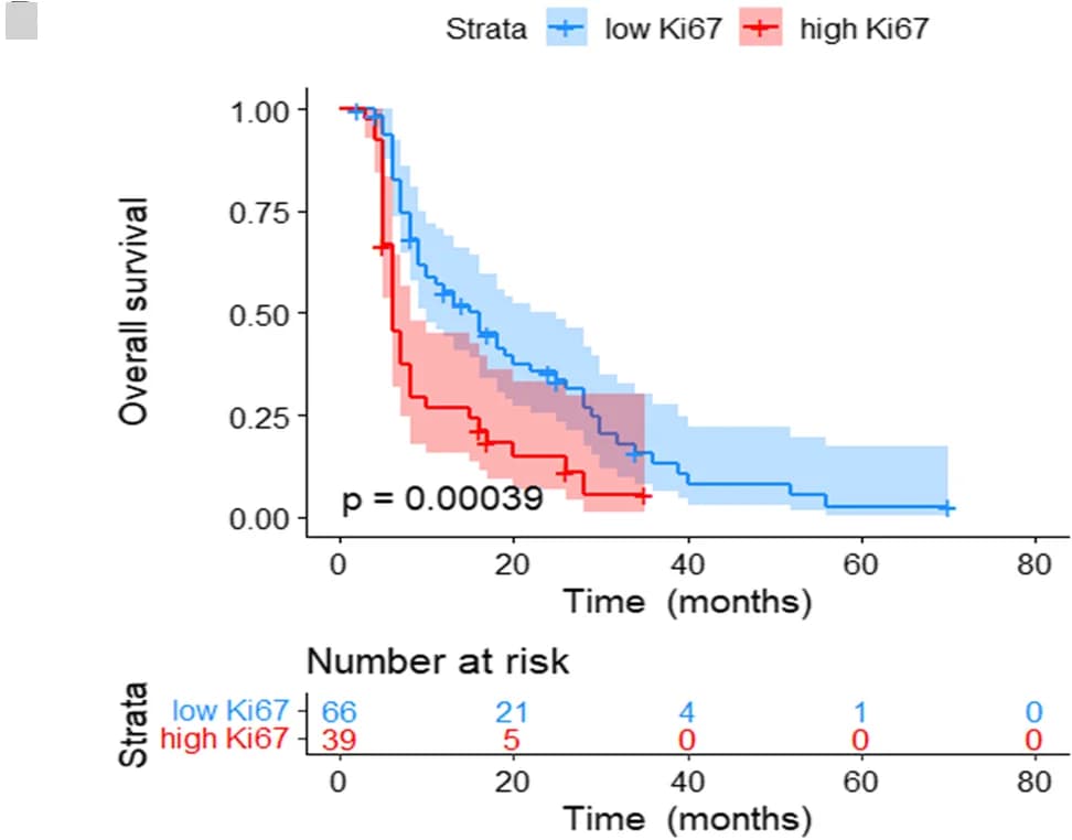 Open access visualization of Survival Curve, Kaplan-Meier Curves, Overall Survival, Ki-67 Expression
