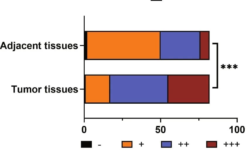 Open access visualization of Stacked Bar Plot, Tumor Samples, IHC Staining, Chi-Square Test, Statistical Significance