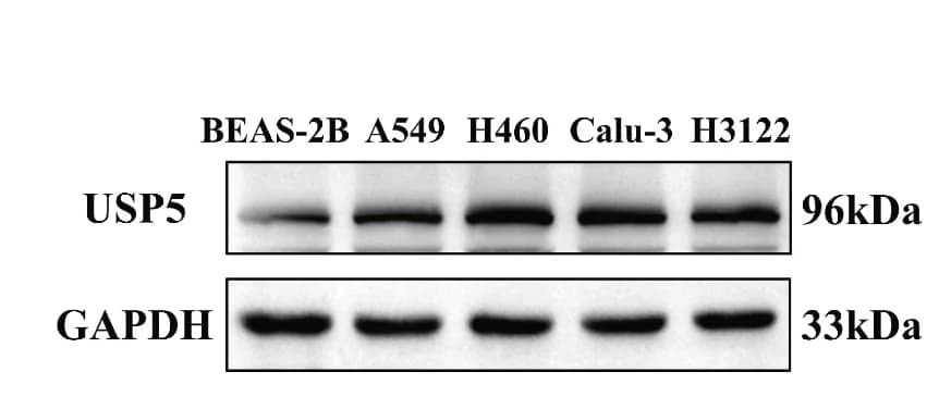 Open access visualization of Gel, USP5 Expression, NSCLC Cells, Non-Epithelial Cells