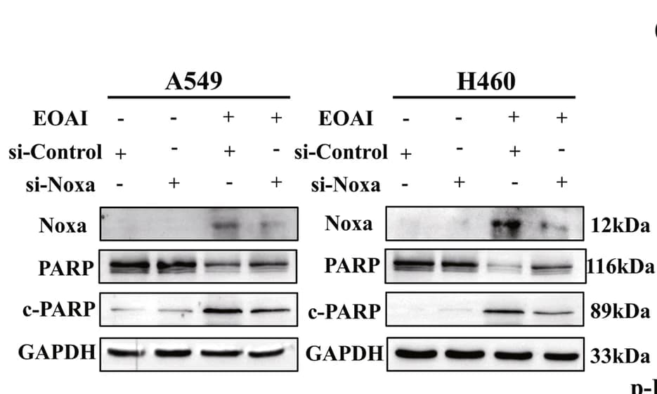 Open access visualization of Gel, siNoxa efficiency, Cleaved PARP, A549 cells, H460 cells