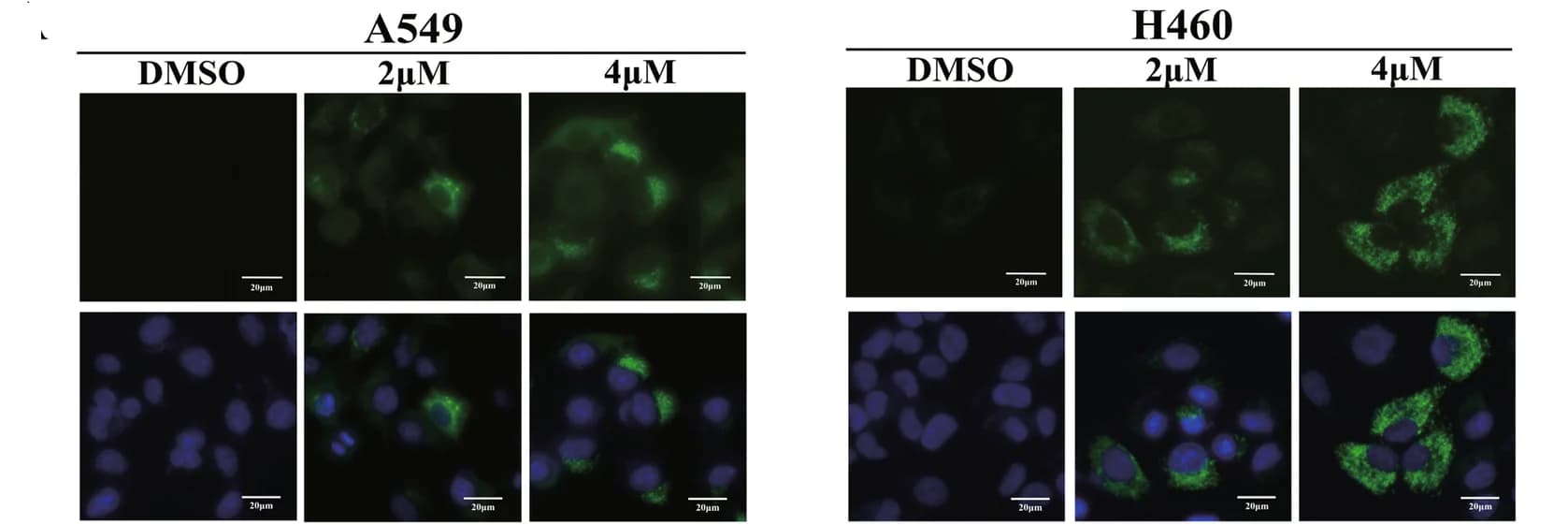 Open access visualization of Microscopy, Immunofluorescence, LC3, A549 Cells, H460 Cells