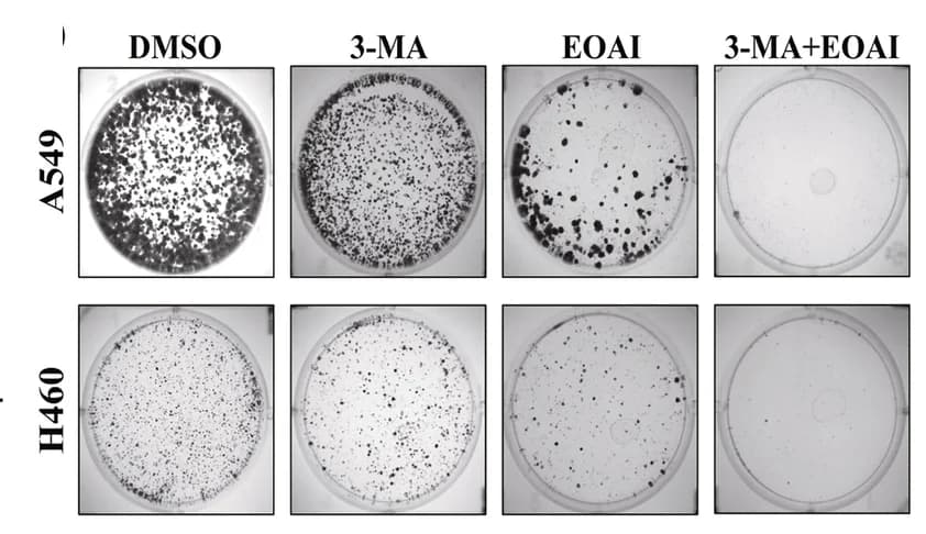 Open access visualization of Microscopy, EOAI, 3MA, Colony Formation, NSCLC Cells