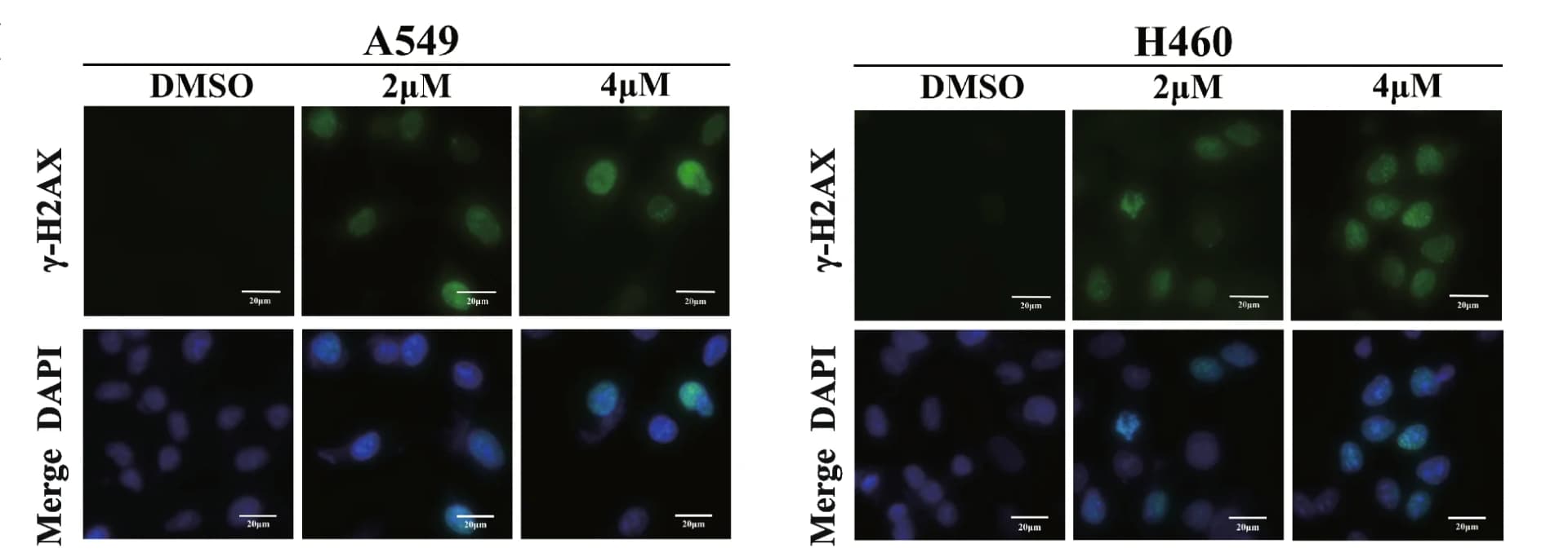 Open access visualization of Microscopy, gamma-H2AX foci, Immunofluorescence, A549 Cells, H460 Cells