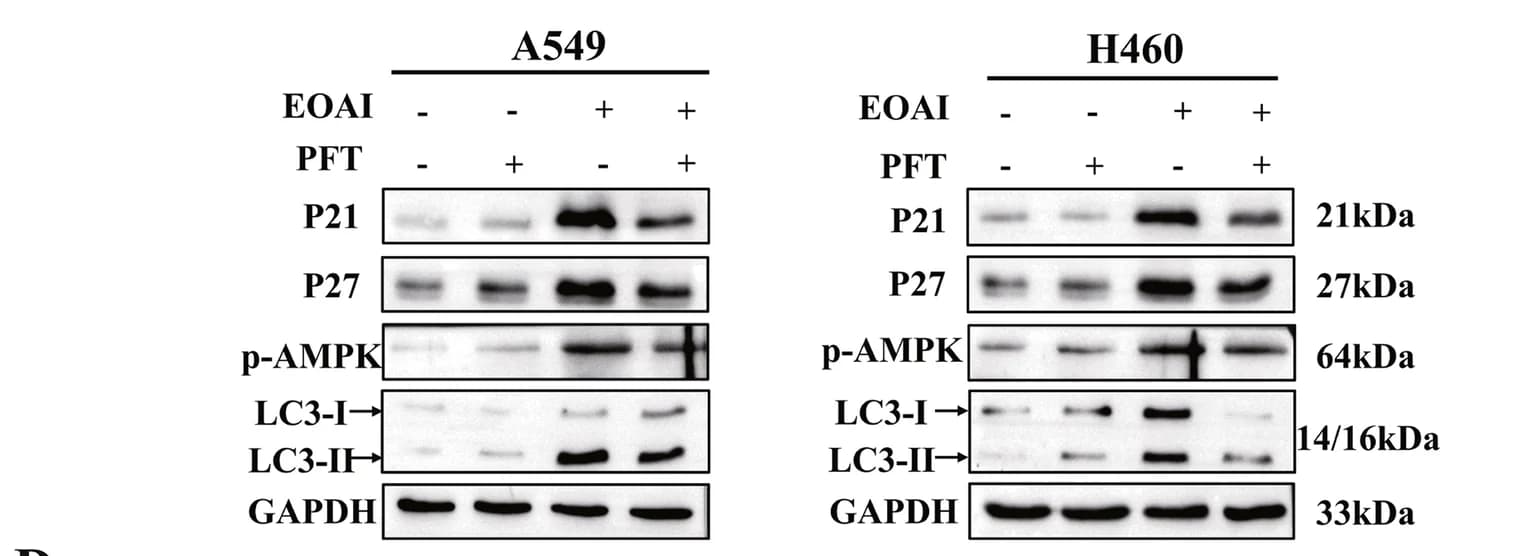 Open access visualization of Gel, PFT, Protein expression, p21, p27