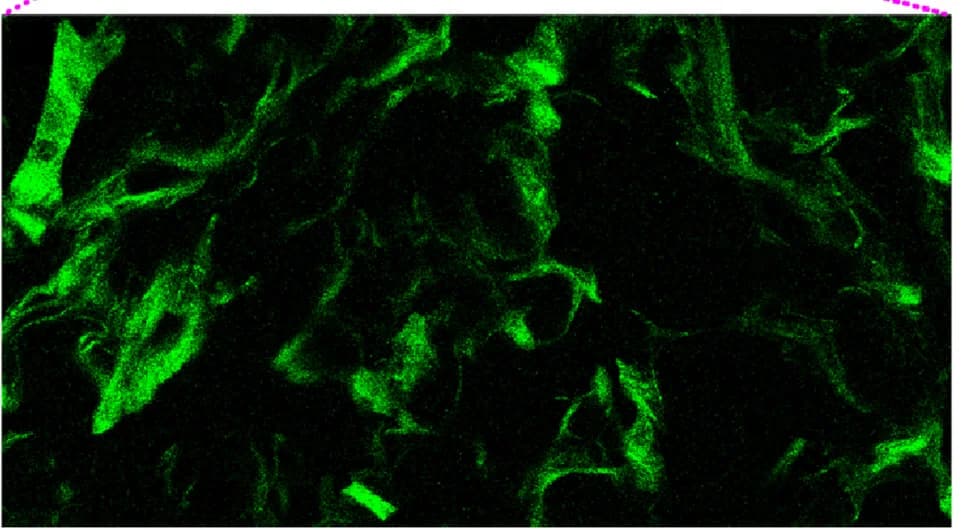 Open access visualization of Microscopy, Zoomed Image, GIST Cells
