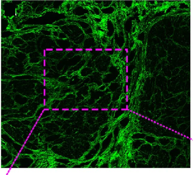 Open access visualization of Microscopy, SHG Image, Collagen Fibers, Adenocarcinoma, Muscularis