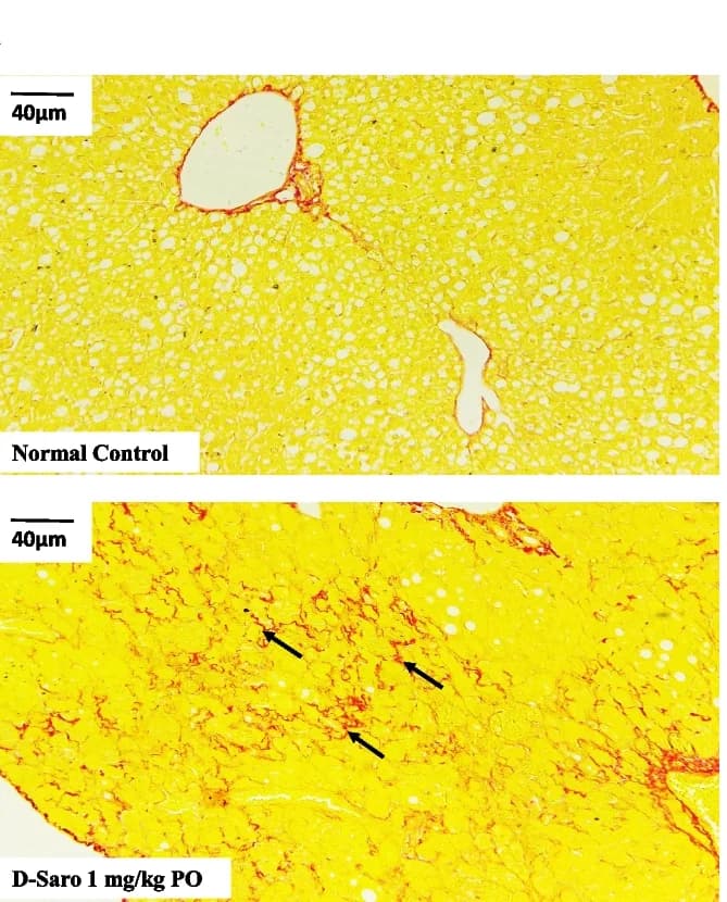 Open access visualization of Microscopy, Liver, Sirius Red Staining, Control Diet