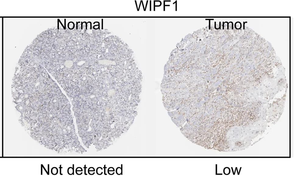 Open access visualization of Microscopy, Protein expression, WIPF1, HNSCC, Normal tissue