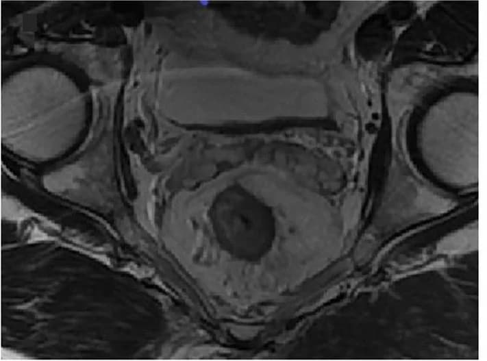 Open access visualization of Photo, T2WI, mrEMVI