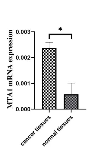 Open access visualization of Bar Plot, Error Bars, qRT-PCR, MTA1 mRNA, Cervical Cancer Tissues