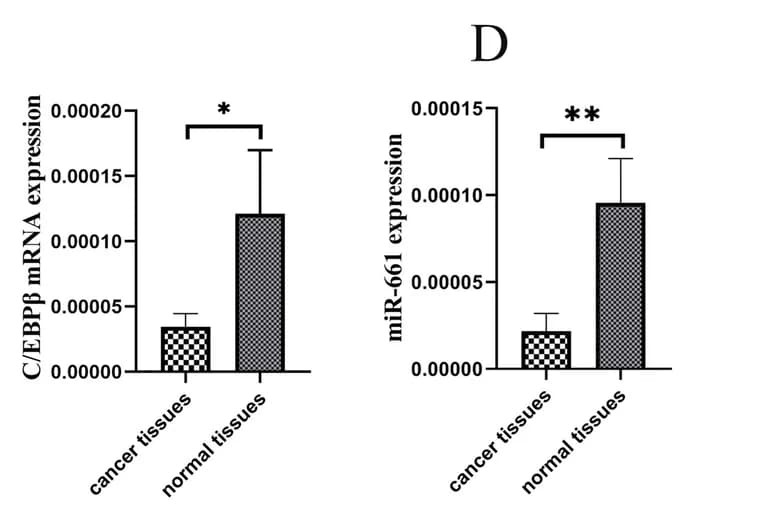 Open access visualization of Bar Plot, Error Bars, qRT-PCR, C/EBPβ mRNA, Cervical Cancer Tissues