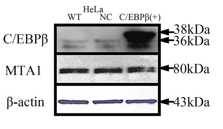 Open access visualization of Gel, Western Blotting, C/EBP Overexpression, MTA1 Expression, Plasmid Transfection