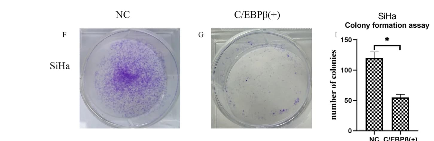 Open access visualization of Bar Plot, Error Bars, Microscopy, Photo, Colony Formation