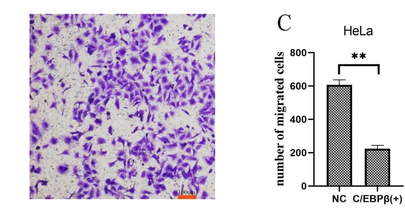 Open access visualization of Bar Plot, Error Bars, Microscopy, Cell Migration, Invasion Assays