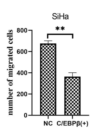 Open access visualization of Bar Plot, Error Bars, Cell Migration, Invasion Assays, C/EBPβ