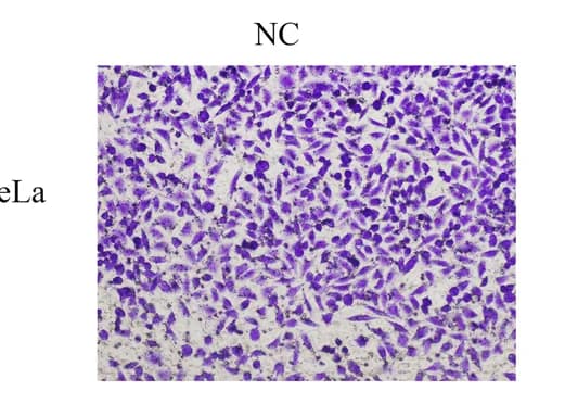 Open access visualization of Microscopy, Cell Invasion, Invasion Assays, C/EBPβ, HeLa Cells