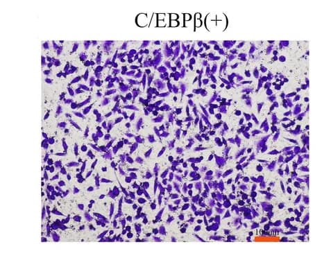 Open access visualization of Microscopy, Cell Invasion, Invasion Assays, C/EBPβ, HeLa Cells