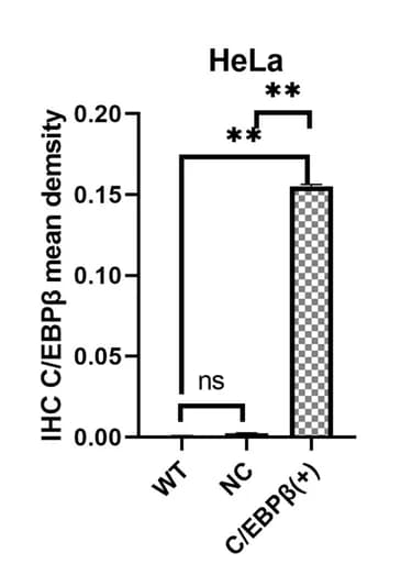 Open access visualization of Bar Plot, Error Bars, Cell Immunohistochemistry, Ki67 Expression, HeLa Cells