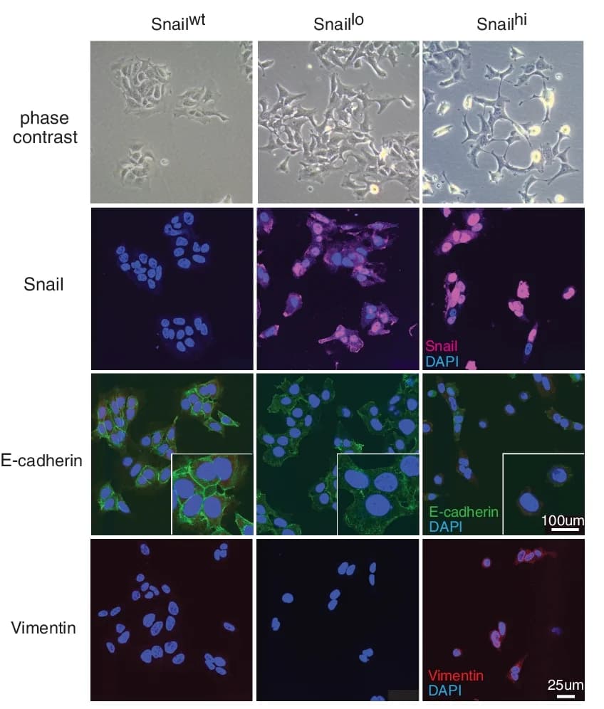Open access visualization of Microscopy, Phase contrast, Immunofluorescence, Cell lines, Mesenchymal morphology