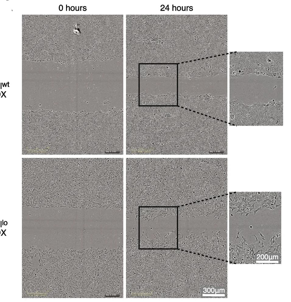 Open access visualization of Microscopy, Scratch Wound Assay, Snail Lo Cells, Cell Migration