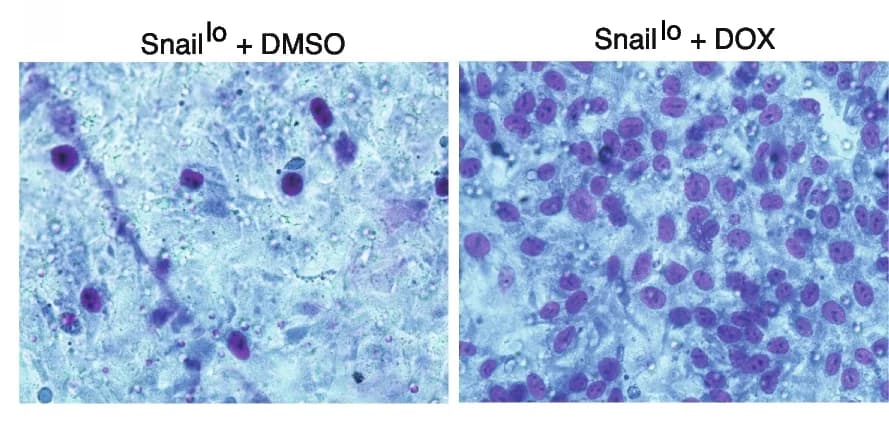 Open access visualization of Microscopy, Transwell Migration Assay, Snail Lo Cells, Cell Migration, Light Microscopy