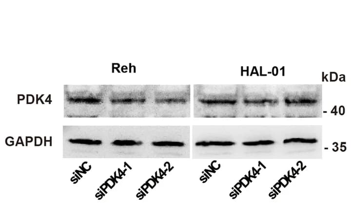Open access visualization of Gel, Western blot, Protein, Control, siNC