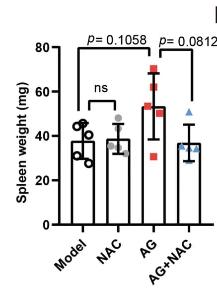 Open access visualization of Bar Plot, Error Bars, Pre-B ALL mice, 1,5-AG, N-acetylcysteine
