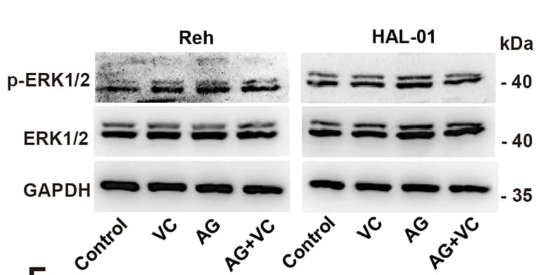 Open access visualization of Gel, p-ERK1/2, ERK1/2, NAC, Vitamin C