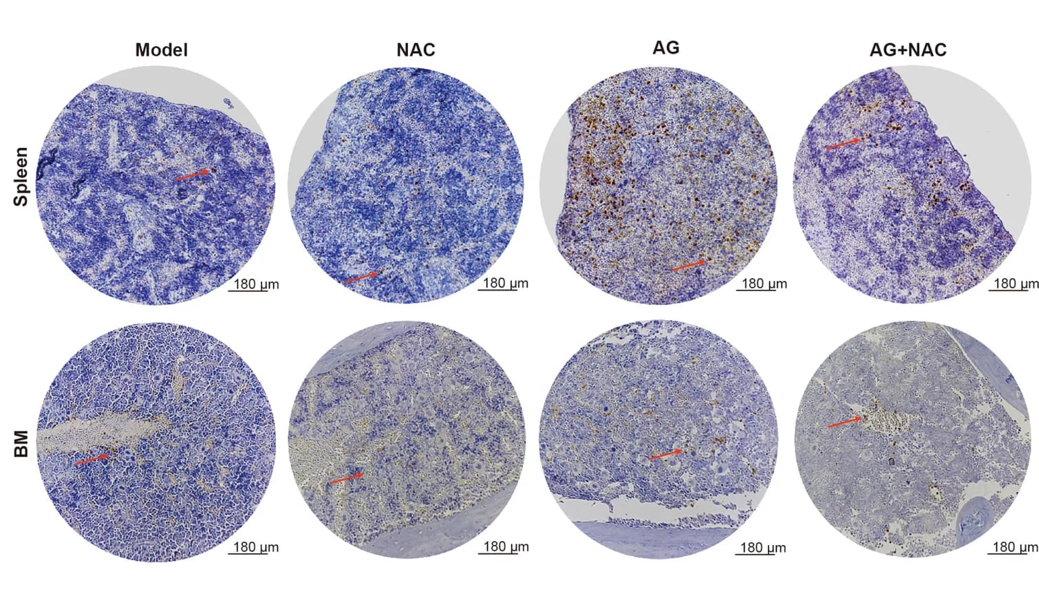 Open access visualization of Microscopy, p-ERK1/2, Spleen, BM, Pre-B ALL