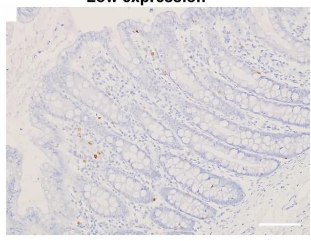 Open access visualization of Microscopy, CD8+ T Cells, Immunohistochemistry, CRC Tissue