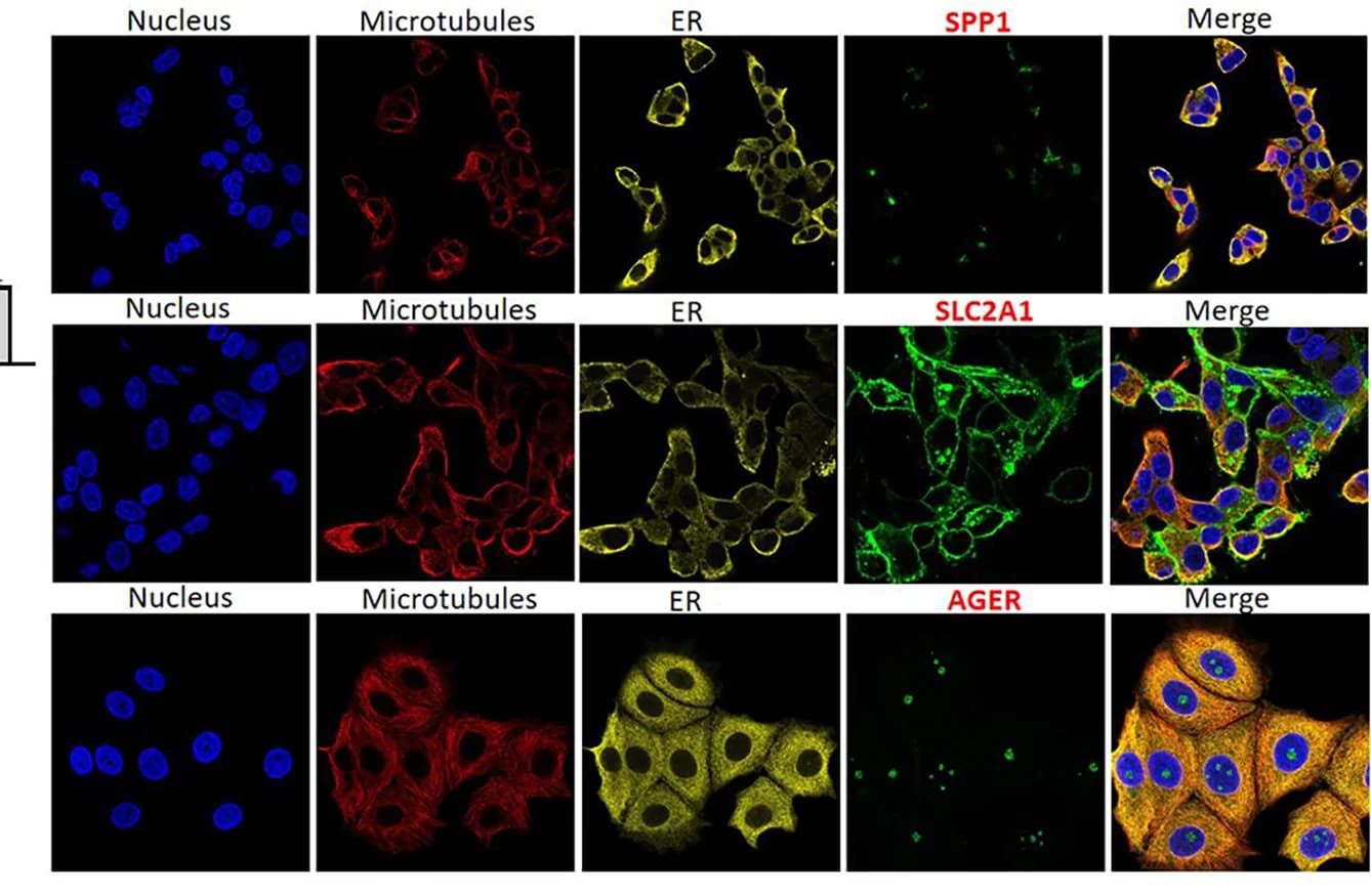 Open access visualization of Microscopy, Immunofluorescence, Confocal Microscopy, Human Cancer Cells, Hep G2