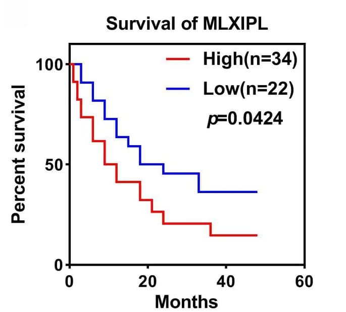Open access visualization of Survival Curve, Line Step, Survival rate, HCC patients, MLXIPL expression