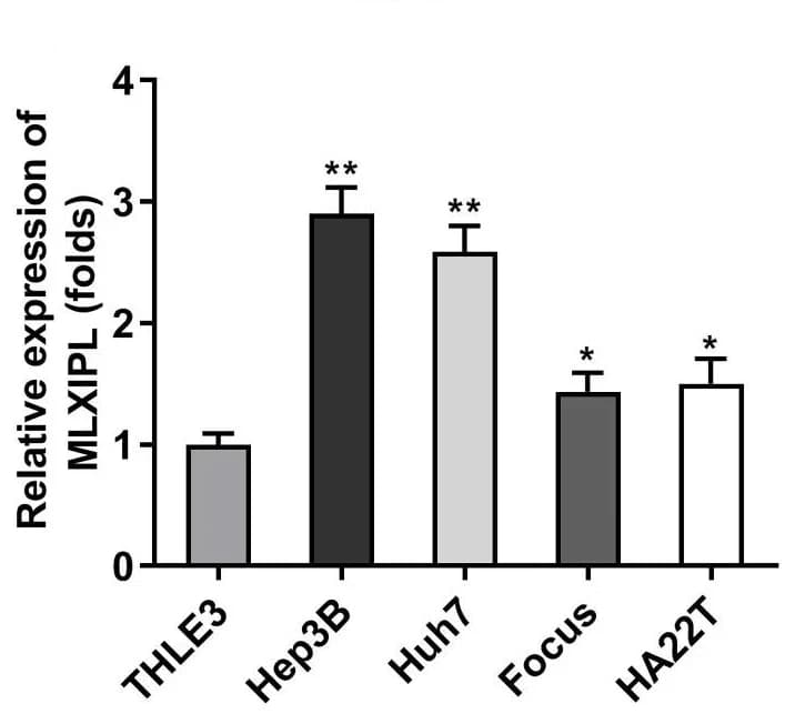 Open access visualization of Bar Plot, Error Bars, MLXIPL, THLE3 cells, Hep3B cells