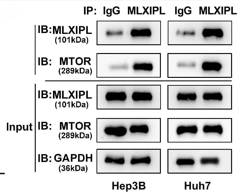 Open access visualization of Gel, MLXIPL, mTOR, Co-IP Assay