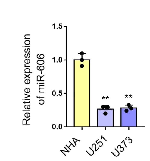 Open access visualization of Bar Plot, Error Bars, qRT-PCR, miR-606, NHA
