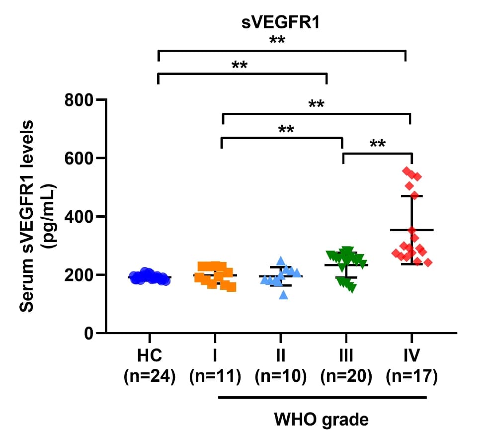 Open access visualization of Scatter Plot, Error Bars, Serum sVEGFR1, Healthy Controls, GBM Patients