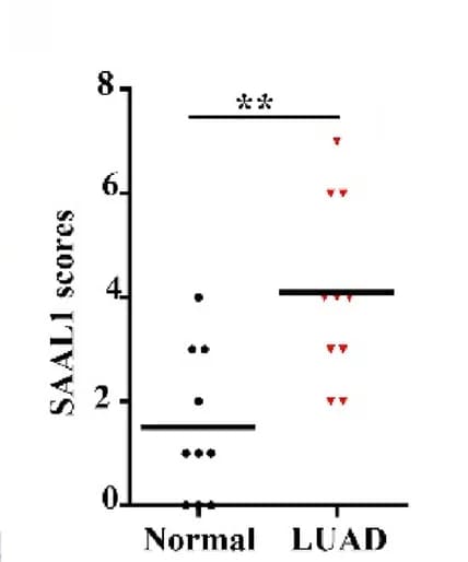 Open access visualization of Scatter Plot, IHC, Clinical Tissues, Lung Adenocarcinoma